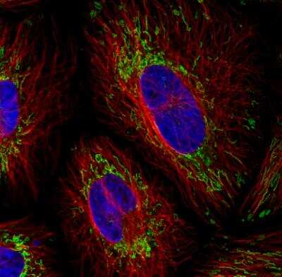 Immunocytochemistry/ Immunofluorescence: TUFM Antibody (CL2245) [NBP2-36753]