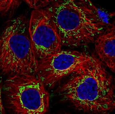 Immunocytochemistry/ Immunofluorescence: TUFM Antibody (CL2245) [NBP2-36753]
