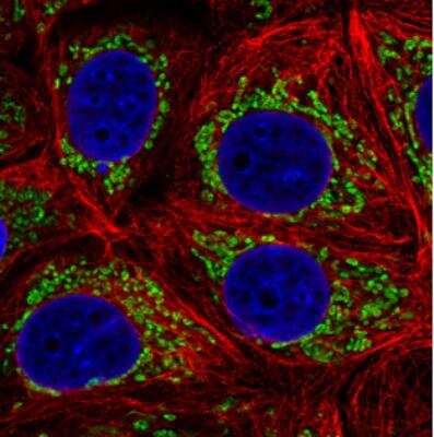 Immunocytochemistry/ Immunofluorescence: TUFM Antibody (CL2245) [NBP2-36753]