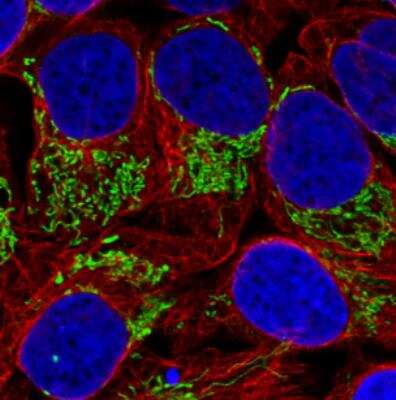 Immunocytochemistry/ Immunofluorescence: TUFM Antibody (CL2245) [NBP2-36753]