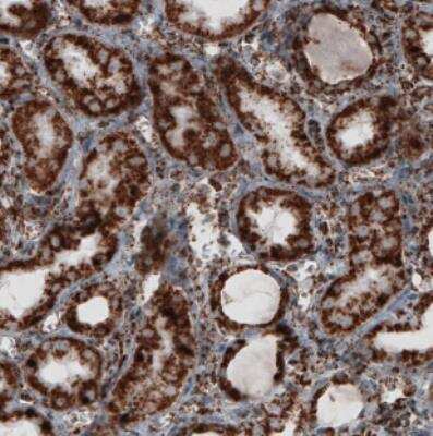 Immunohistochemistry-Paraffin: TUFM Antibody (CL2245) [NBP2-36753]