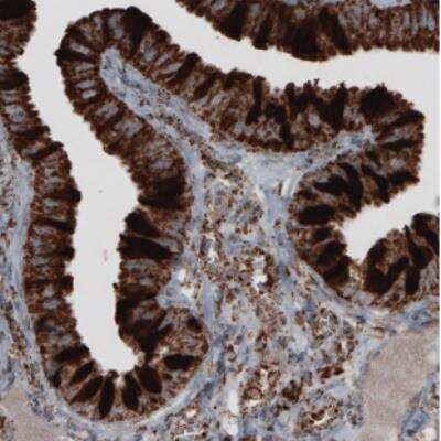 Immunohistochemistry-Paraffin: TUFM Antibody (CL2245) [NBP2-36753]