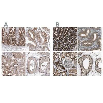 Immunohistochemistry-Paraffin: TUFM Antibody [NBP1-84889]