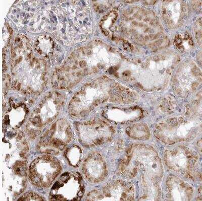 Immunohistochemistry-Paraffin: TUFM Antibody [NBP1-84889]