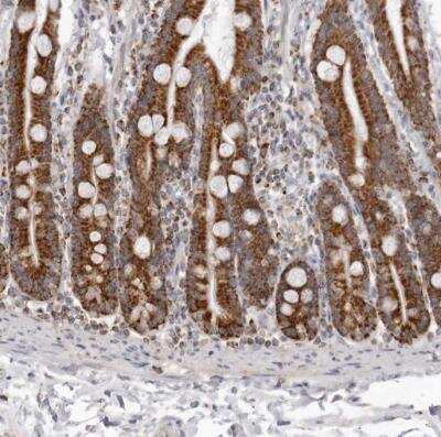 Immunohistochemistry-Paraffin: TUFM Antibody [NBP1-84889]