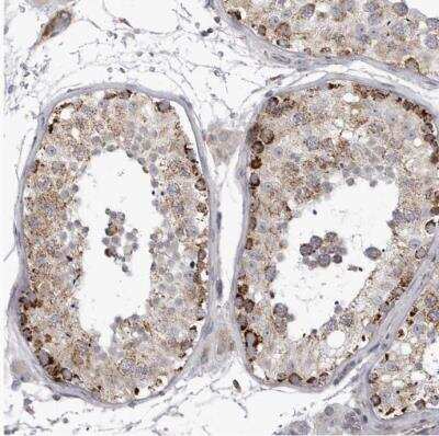 Immunohistochemistry-Paraffin: TUFM Antibody [NBP1-84889]
