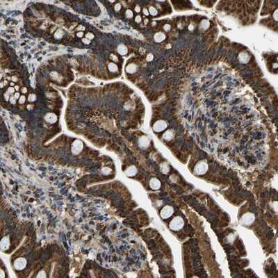 Immunohistochemistry-Paraffin: TUFM Antibody [NBP1-84890]