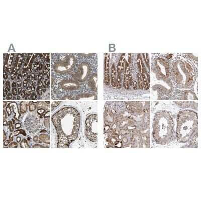 Immunohistochemistry-Paraffin: TUFM Antibody [NBP1-84890]