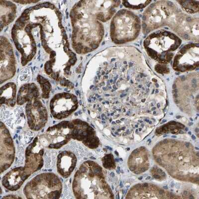 Immunohistochemistry-Paraffin: TUFM Antibody [NBP1-84890]