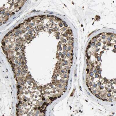 Immunohistochemistry-Paraffin: TUFM Antibody [NBP1-84890]