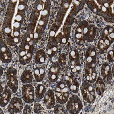 Immunohistochemistry-Paraffin: TUFM Antibody [NBP1-84890]