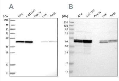 Western Blot: TUFM Antibody [NBP1-84889]