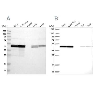 Western Blot: TUFM Antibody [NBP1-84890]