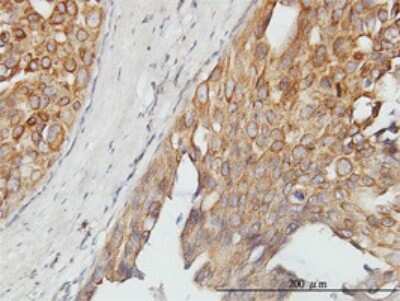 Immunohistochemistry-Paraffin: TUG Antibody (3D10-1D11) [H00079058-M01]