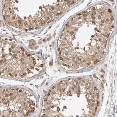 Immunohistochemistry-Paraffin: TUG Antibody [NBP1-90079]