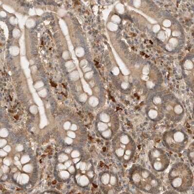 Immunohistochemistry-Paraffin: TUG Antibody [NBP1-90079]