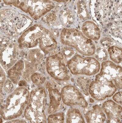 Immunohistochemistry-Paraffin: TUG Antibody [NBP1-90079]