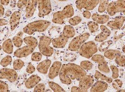 Immunohistochemistry-Paraffin: TUG Antibody [NBP3-12632]