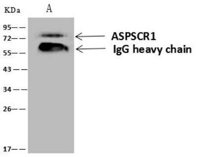 Immunoprecipitation: TUG Antibody [NBP3-12632]