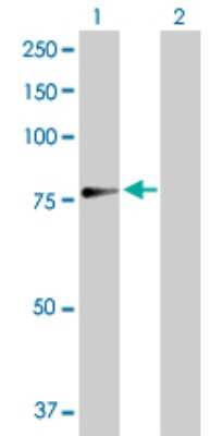 Western Blot: TUG Antibody [H00079058-D01P]