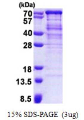 SDS-PAGE: Recombinant Human TUG His Protein [NBP2-22682]