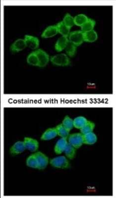 Immunocytochemistry/ Immunofluorescence: TULA/STS-2 Antibody [NBP2-20763]