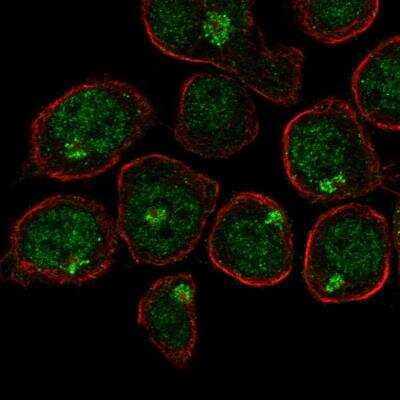 Immunocytochemistry/ Immunofluorescence: TULA/STS-2 Antibody [NBP2-48637]