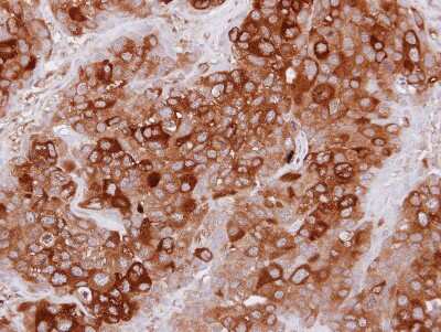 Immunohistochemistry-Paraffin: TULA/STS-2 Antibody [NBP2-20763]