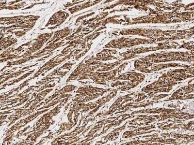 Immunohistochemistry-Paraffin: TULA/STS-2 Antibody [NBP3-00200]