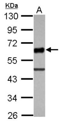 Western Blot: TULA/STS-2 Antibody [NBP2-20762]