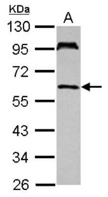 Western Blot: TULA/STS-2 Antibody [NBP2-20763]