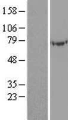 Western Blot: TULA/STS-2 Overexpression Lysate [NBL1-17506]