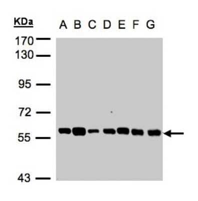 Western Blot: TULP1 Antibody [NBP1-31401]