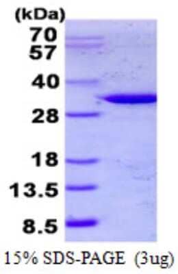 SDS-PAGE: Recombinant Human TULP1 His Protein [NBP2-22896]