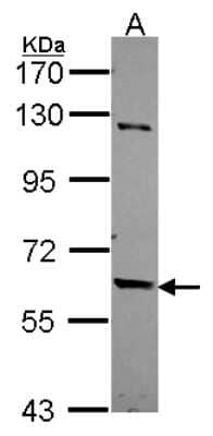 Western Blot: TULP2 Antibody [NBP2-15151]