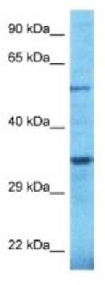 Western Blot: TULP2 Antibody [NBP3-10301]