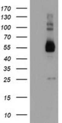 Western Blot: TULP3 Antibody (OTI7B8) [NBP2-01671]