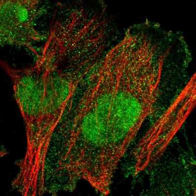 Immunocytochemistry/ Immunofluorescence: TULP3 Antibody [NBP2-55375]