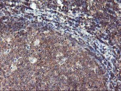 Immunohistochemistry: TULP3 Antibody (OTI7B8) - Azide and BSA Free [NBP2-74721]