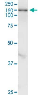 Western Blot: TULP4 Antibody (7B7) [H00056995-M05-100ug]