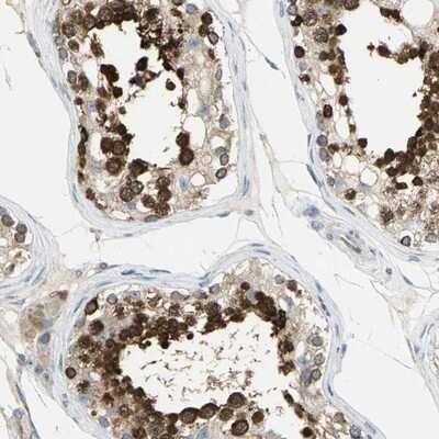 Immunohistochemistry-Paraffin: TULP4 Antibody [NBP1-92546]
