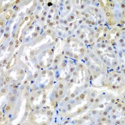 Immunohistochemistry-Paraffin: TUSC2 Antibody - BSA Free [NBP3-04411]