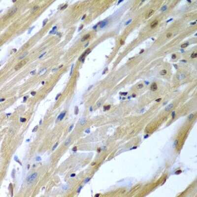 Immunohistochemistry-Paraffin: TUSC2 Antibody - BSA Free [NBP3-04411]