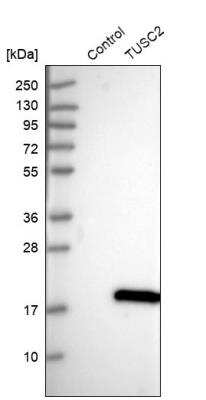 Western Blot: TUSC2 Antibody [NBP1-86794]