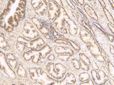 Immunohistochemistry-Paraffin: TUSC3 Antibody [NBP1-00248]