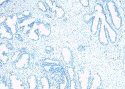 Immunohistochemistry-Paraffin: TUSC3 Antibody [NBP1-00248]