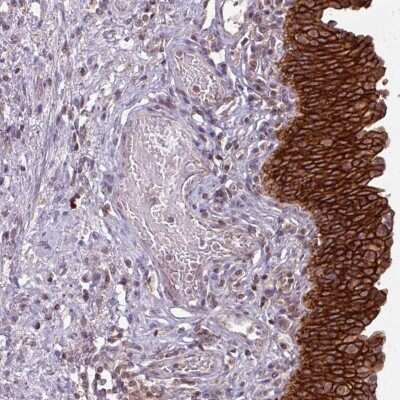 Immunohistochemistry-Paraffin: TUSC3 Antibody [NBP2-48952]