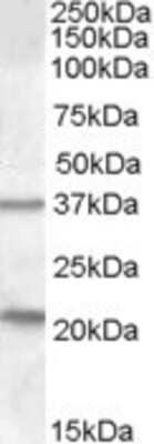 Western Blot: TUSC3 Antibody [NBP1-00248]