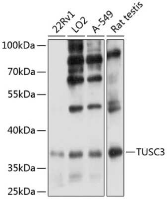 Western Blot: TUSC3 AntibodyAzide and BSA Free [NBP2-93249]