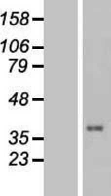 Western Blot: TUSC3 Overexpression Lysate [NBL1-17455]